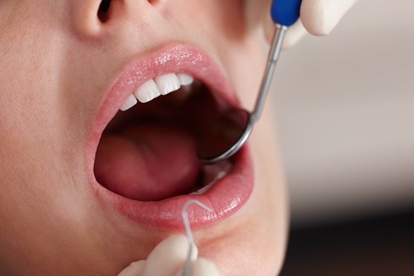 How Often Should You Get A Dental Cleaning?